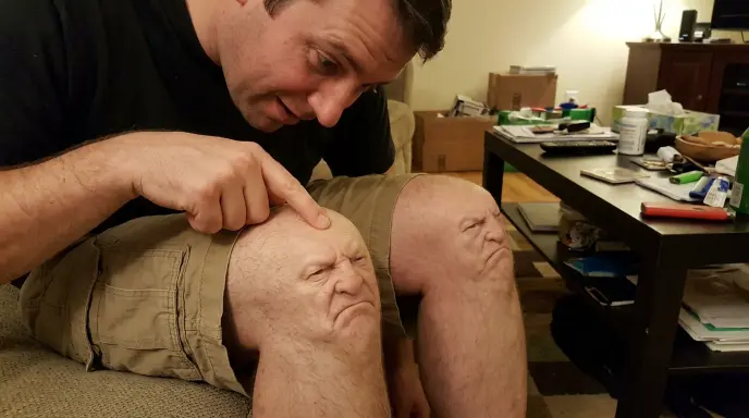 Puns About Knees